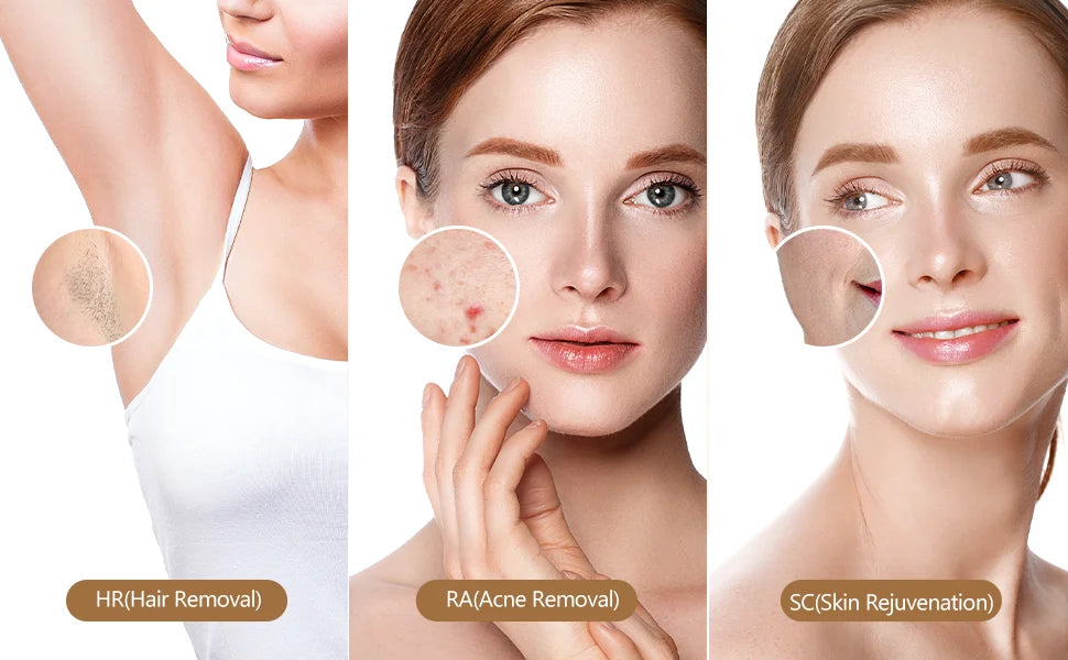 SilkLux™ Pro — Permanent IPL Laser Hair Removal Handset